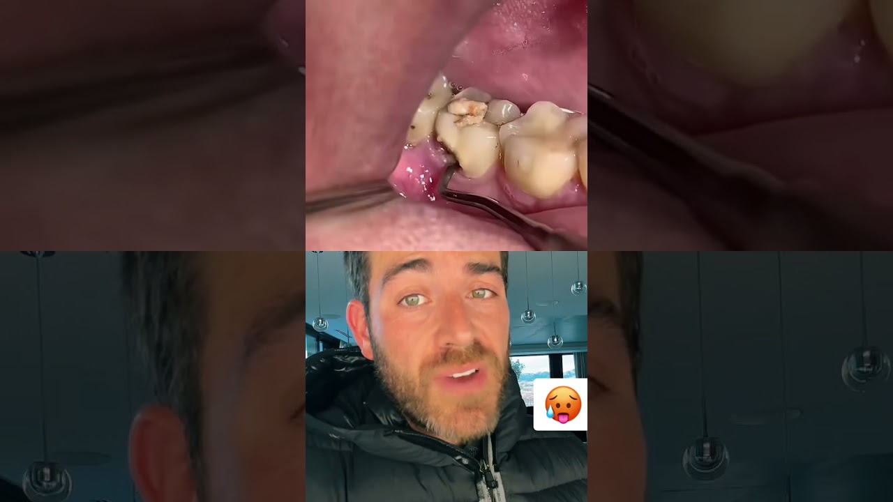 Il consulte parce qu’il a une mauvaise haleine et voilà ce qu’il trouve’🥵 #shorts