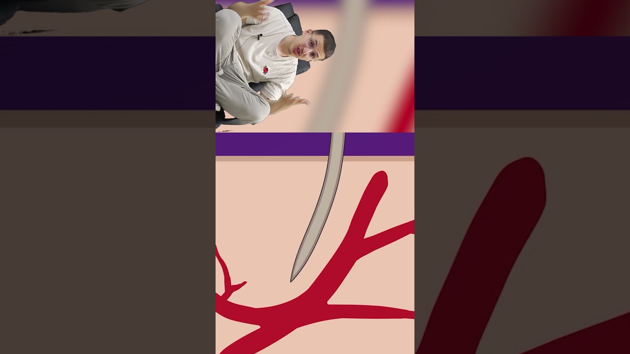 Comment les moustiques nous piquent et comment les repousser - @RiadhOFG