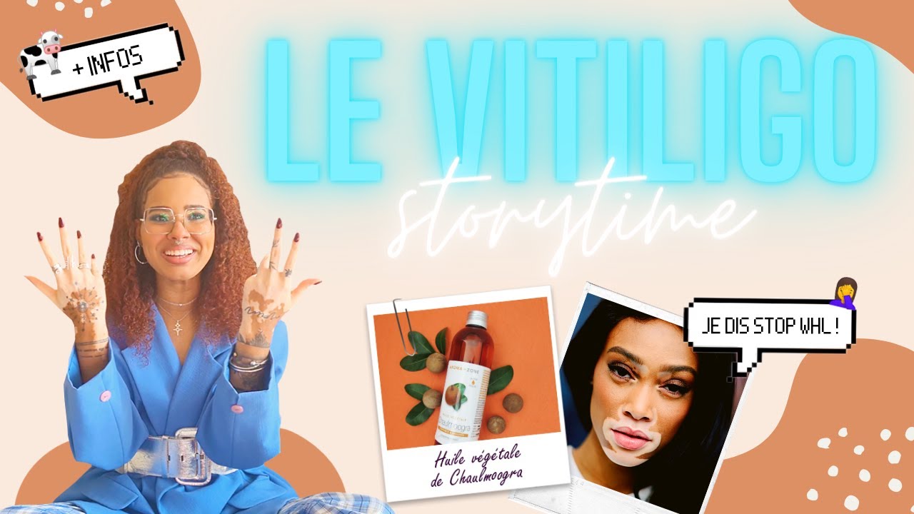 STORY TIME : Vitiligo, Traitements Naturels (+ choses à savoir) 🐄